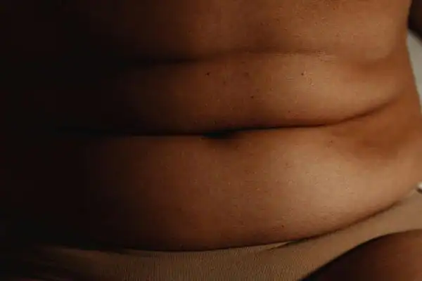 The Hidden Connection: How Stress Shapes Your Fitness and Body Composition 3 image of what stress can do on the stomach area and how Lipo 360 Royal Leamington Spa can help to change your body shape.